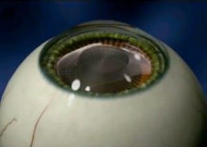 visian1-300x213