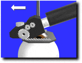 lasik3 (1)