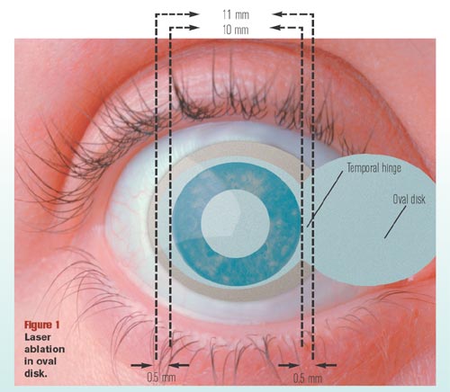 oval-flap
