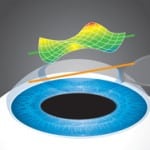 wavefrontMapping-150x150