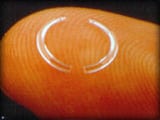 Intacs Corneal Ring Segments Raleigh